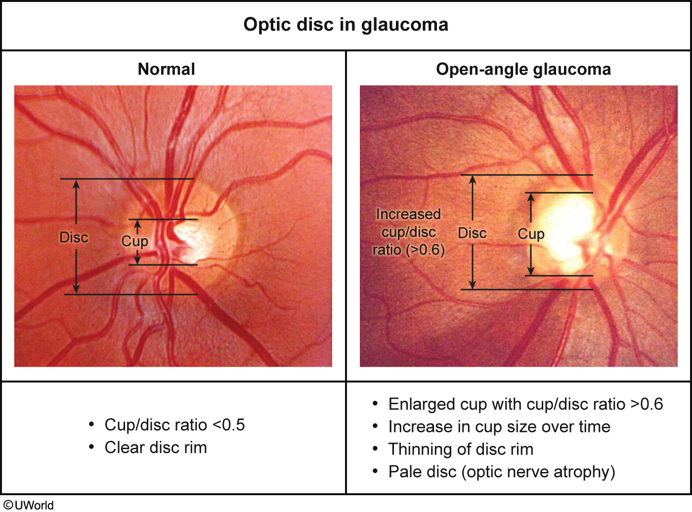 Eyes, Ears, Nose, and Throat PANCE Online Test Prep