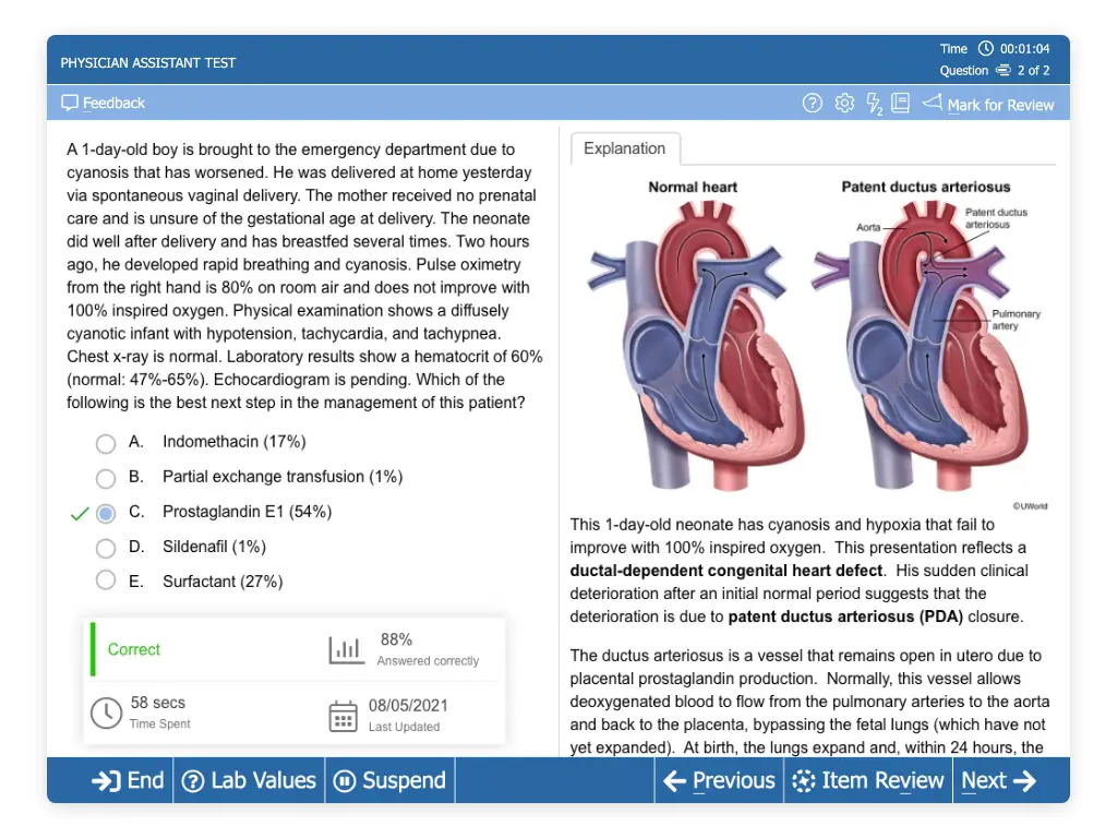 UWorld PA QBank question depicting a congenital heart defect
