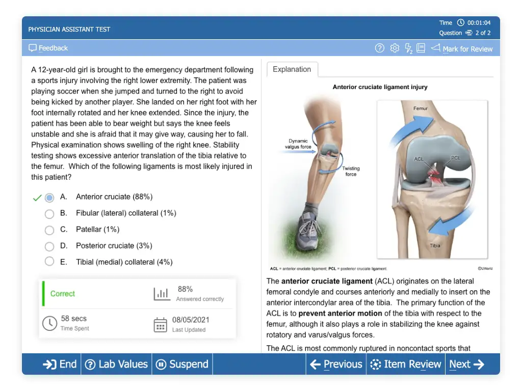 UWorld PA QBank question depicting an anterior cruciate ligament injury