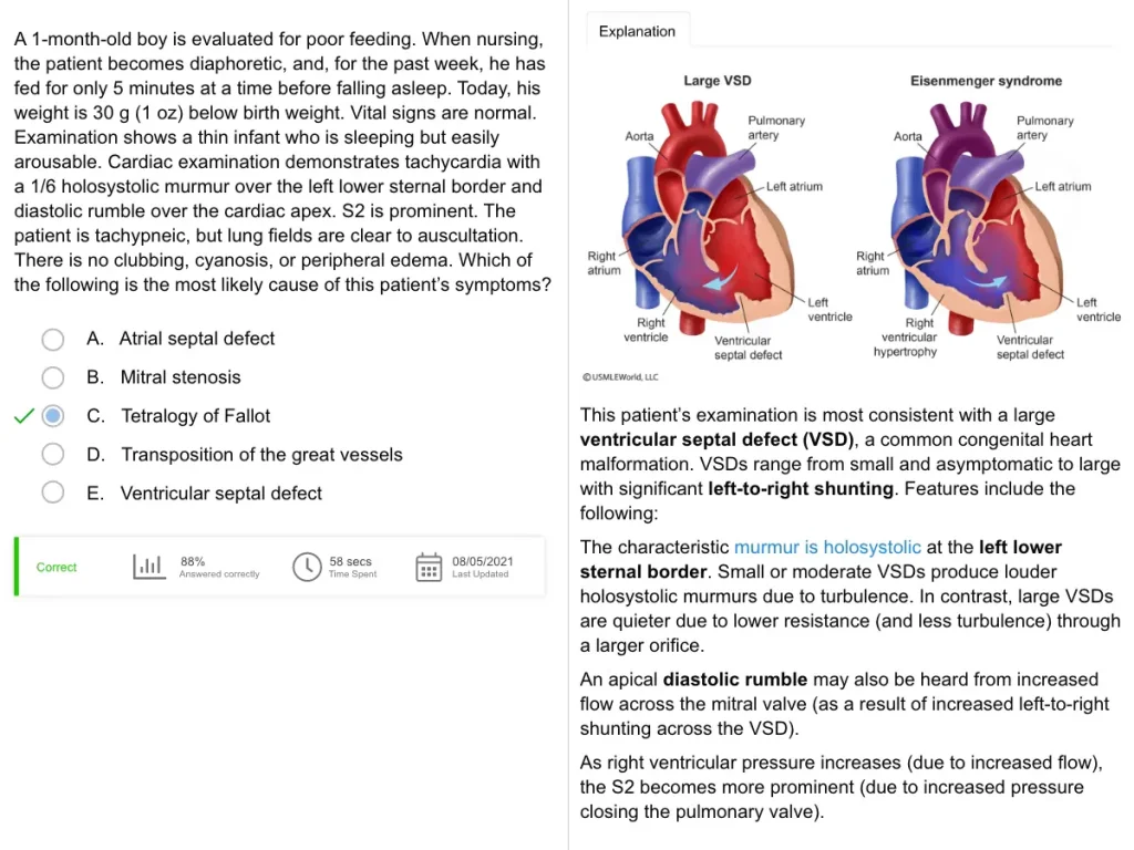 UWorld PANRE question depicting eisenmenger syndrome